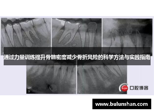 通过力量训练提升骨骼密度减少骨折风险的科学方法与实践指南